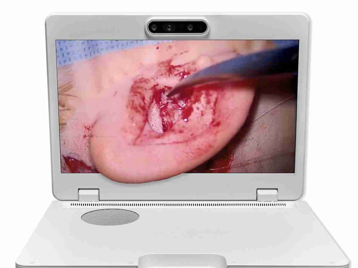 达擎之＂Heads-up 3D显微手术显示系统＂，，，，整合4K裸眼3D显示及眼球追踪系统，，具备快速追踪人眼移动位置功能，，减轻医师长时间维持固定姿势的负担，，让医师能有更宽广清晰的3D立体视野及更舒适的姿势来执行手术。。。。